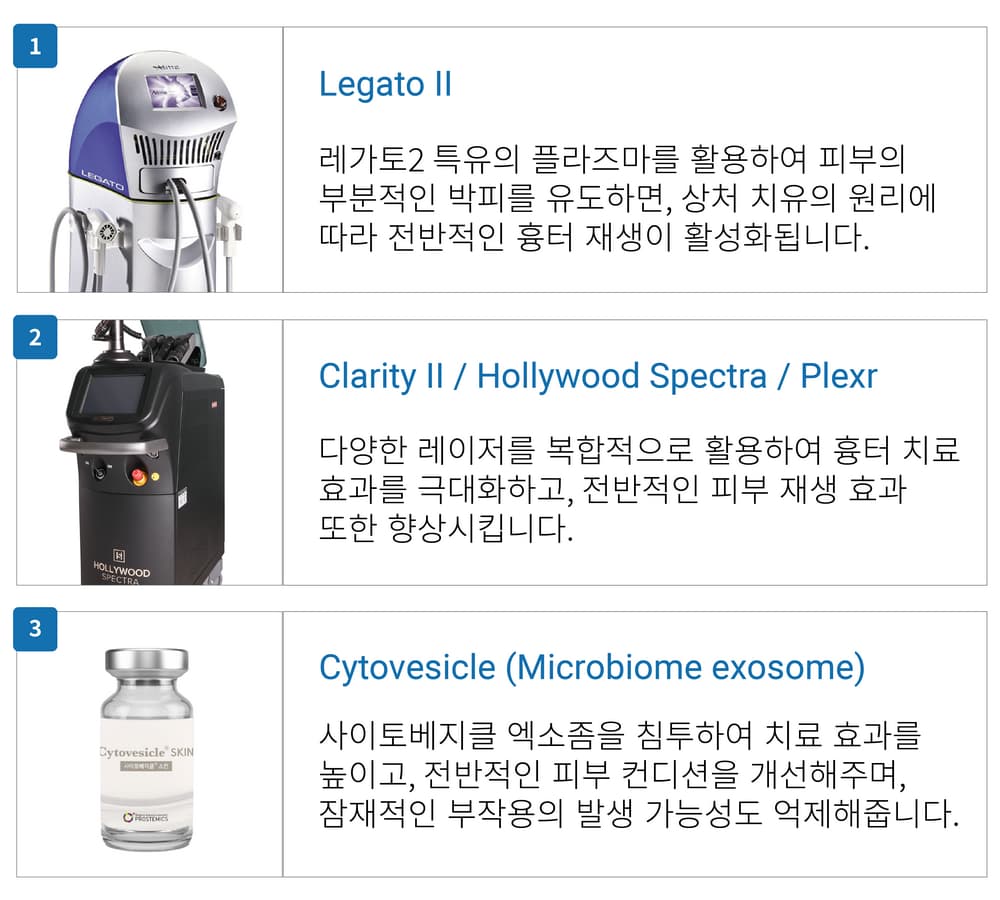 레가토2 (Legato II)