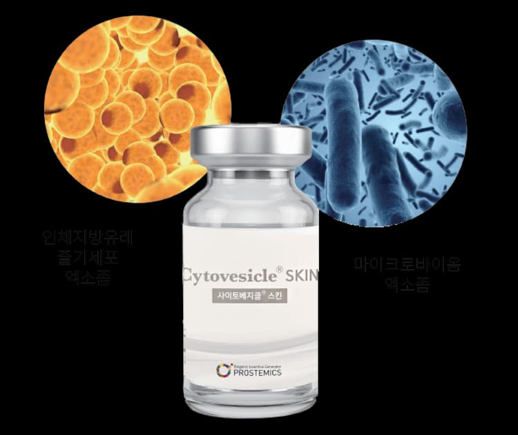 Cytovesicle